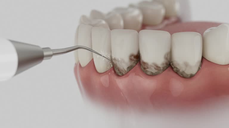 Trusted Dental Crowns And Bridges service in Magee, MS - Dentist Open Now